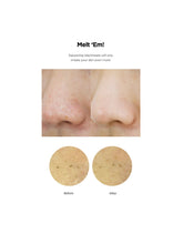 Load image into Gallery viewer, ma:nyo  Blackhead Kill 50 Pad