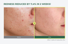 Load image into Gallery viewer, Anua Heartleaf 77% Soothing Toner I pH 5.5 Skin Trouble Care 250Ml