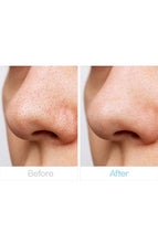 Load image into Gallery viewer, Labonita Scrubby Bubble Nose Pack 1pack(10 sheets)