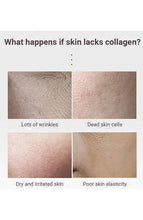 Load image into Gallery viewer, Prorance Anti-wrinkle Multi Balm 10G
