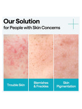 Load image into Gallery viewer, [MEDIHEAL] Madecassoside Blemish Repair Serum (40ml/1.35fl.oz)
