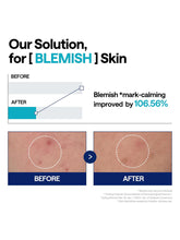 Load image into Gallery viewer, [MEDIHEAL] Madecassoside Blemish Repair Serum (40ml/1.35fl.oz)
