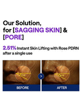Load image into Gallery viewer, [Mediheal] PDRN Lifting Serum (40ml/1.35fl.oz)
