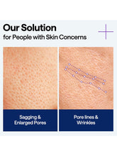 Load image into Gallery viewer, [Mediheal] PDRN Lifting Serum (40ml/1.35fl.oz)
