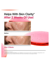 Load image into Gallery viewer, [Anua] Niacinamide 10% + TXA 4% Serum (30mL/1.01 fl.oz)
