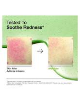 Load image into Gallery viewer, [Anua] Azelaic Acid 10 Hyaluron Redness Soothing Serum (30mL/1.01fl.oz)

